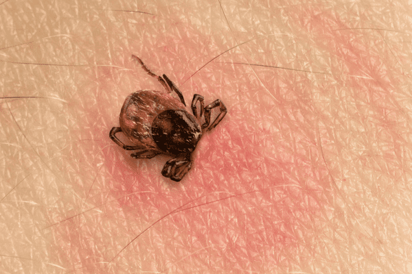 tick bites on dogs